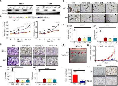 Corrigendum: PHF20 promotes glioblastoma cell malignancies through a WISP1/BGN-dependent pathway